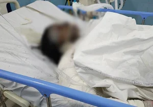 हजारीबाग सदर एसडीओ और उनके परिवार वालों पर पत्नी को जलाने का आरोप, पुलिस से शिकायत
