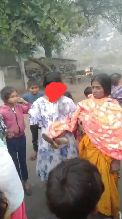 विधवा महिला और उसकी नाबालिग बेटी को जूते की माला पहनाकर घुमाने वालों पर मामला दर्ज