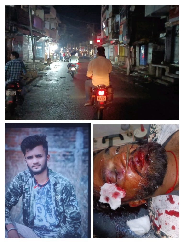 BIG BREAKING CHATRA :अज्ञात अपराधियों नें की युवक की बेरहमी से पिटाई, धारदार हथियार से किया जानलेवा हमला