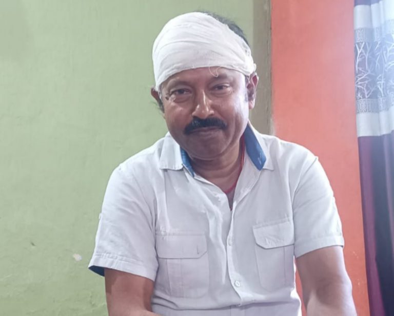 पंखा गिरने से हुए अधिवक्ता घायल 